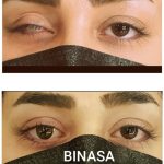 کلینیک پروتز چشم بیناسا در تهران