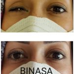 کلینیک پروتز چشم بیناسا در تهران