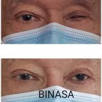 کلینیک پروتز چشم بیناسا در تهران