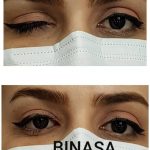 کلینیک پروتز چشم بیناسا در تهران