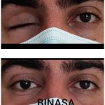 کلینیک پروتز چشم بیناسا در تهران