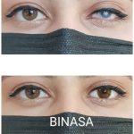 کلینیک پروتز چشم بیناسا در تهران