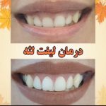 کلینیک دندانپزشکی دکتر راستگو در آبادان و تهران