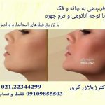 بهترین پزشک پوست و زیبایی در شهرک غرب