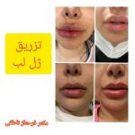 دکتر فرحناز ناطقی در اصفهان