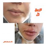 دکتر فرحناز ناطقی در اصفهان