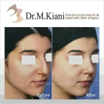 دکتر مژگان کیانی آسیابر متخصص گوش و حلق و بینی در تهران