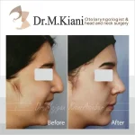 دکتر مژگان کیانی آسیابر متخصص گوش و حلق و بینی در تهران