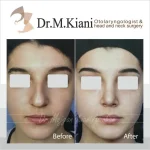 دکتر مژگان کیانی آسیابر متخصص گوش و حلق و بینی در تهران
