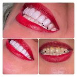 دکتر فوزیه رحمانی در هرمزگان