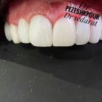 دکتر شیرین پزشکپور در تهران