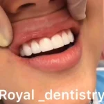 دندانپزشکی رویال در کرج