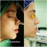 دکتر هادی گل شکن