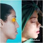 دکتر هادی گل شکن