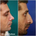 دکتر هادی گل شکن