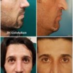 دکتر هادی گل شکن