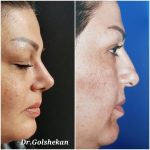 دکتر هادی گل شکن