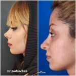 دکتر هادی گل شکن