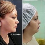 دکتر هادی گل شکن