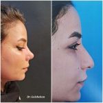 دکتر هادی گل شکن