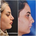 دکتر هادی گل شکن