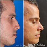 دکتر هادی گل شکن