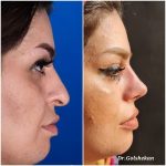 دکتر هادی گل شکن