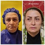 دکتر هادی گل شکن