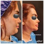 دکتر هادی گل شکن