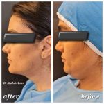 دکتر هادی گل شکن