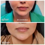 دکتر هادی گل شکن