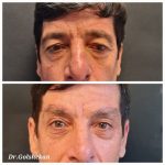 دکتر هادی گل شکن