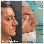 دکتر هادی گل شکن