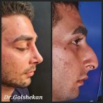 دکتر هادی گل شکن