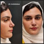 دکتر هادی گل شکن