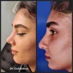 دکتر هادی گل شکن