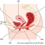 فیزیوتراپی کف لگن التیام در کرمان