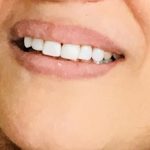 دندانپزشک خوب در تبریز