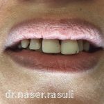 دندانپزشک خوب در تبریز