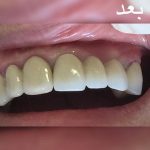 دندانپزشک خوب در تبریز