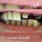 دندانپزشک خوب در تبریز