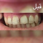 دندانپزشک خوب در تبریز