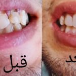 دکتر محمود قره باغلو در میاندوآب