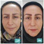 کلینیک زیبایی و لیزر غزل در بابل