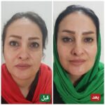 کلینیک زیبایی و لیزر غزل در بابل