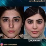 دکتر روزینا بشارتی زاده در تهران