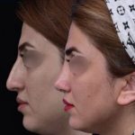 دکتر روزینا بشارتی زاده در تهران