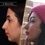 دکتر روزینا بشارتی زاده در تهران