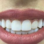 مرکز دندانپزشکی دکتر زمانی در لار