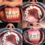 دکتر آرش غفارزاده در بروجرد